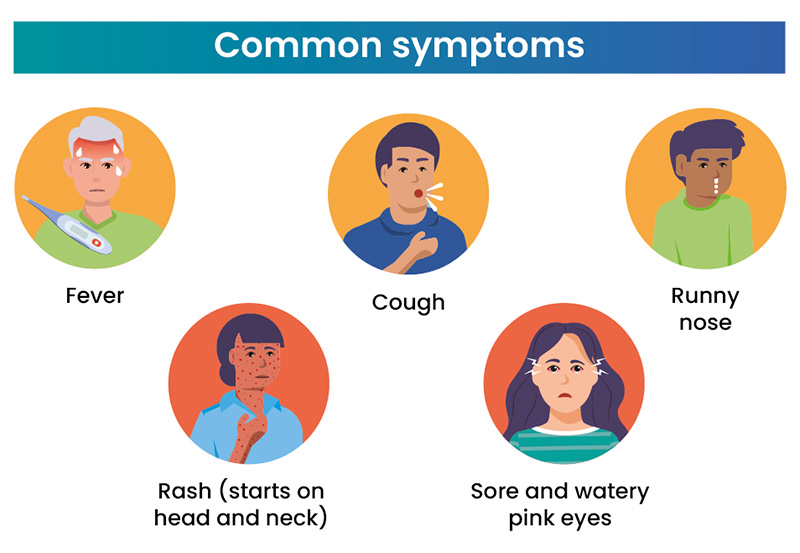 Measles – how to recognise